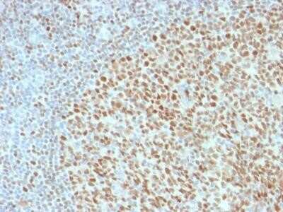 Immunohistochemistry-Paraffin: POU2F2 Antibody (Oct2/2136) [NBP2-75732]