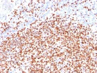 Immunohistochemistry-Paraffin: POU2F2 Antibody (OCT2/2137) [NBP2-75734]