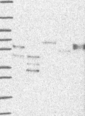 Western Blot: OCT2 Antibody [NBP3-16966]