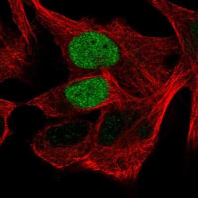Immunocytochemistry/ Immunofluorescence: OCT6 Antibody [NBP2-58020]