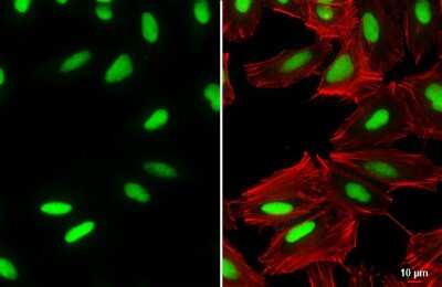 Immunocytochemistry/ Immunofluorescence: OCT6 Antibody [NBP3-13349]