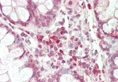Immunohistochemistry-Paraffin: OCT6 Antibody [NBP3-10963]