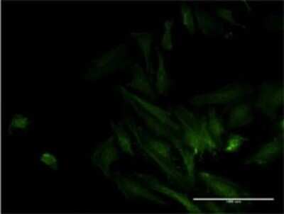 Immunocytochemistry/ Immunofluorescence: ODF2 Antibody (1A1) [H00004957-M01]