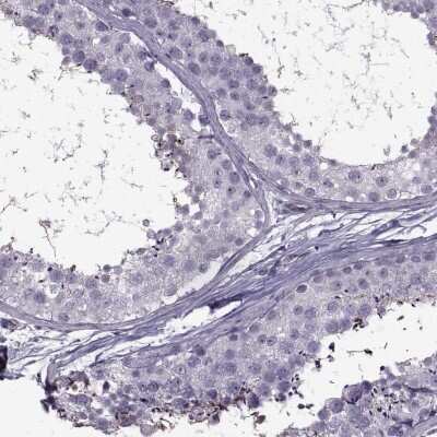 Immunohistochemistry-Paraffin: ODF3 Antibody [NBP1-90614]