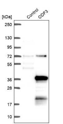 Western Blot: ODF3 Antibody [NBP2-32628]