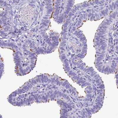 Immunohistochemistry-Paraffin: ODF3B Antibody [NBP2-32371]