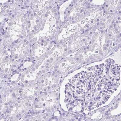 Immunohistochemistry-Paraffin: ODF3B Antibody [NBP2-32371]