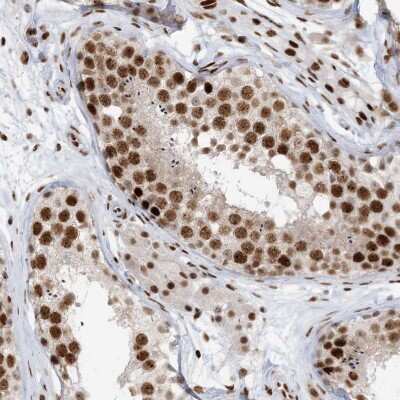 Immunohistochemistry: OFCC1 Antibody [NBP2-47348]