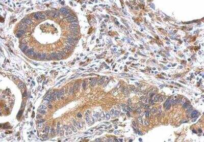 Immunohistochemistry-Paraffin: OFD1 Antibody [NBP1-32843]