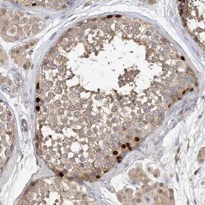 Immunohistochemistry-Paraffin: OFD1 Antibody [NBP1-89354]