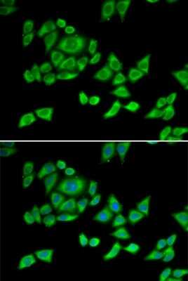 Immunocytochemistry/ Immunofluorescence: OGDH Antibody - BSA Free [NBP2-94086]