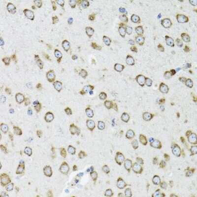 Immunohistochemistry-Paraffin: OGDH Antibody - BSA Free [NBP2-94086]