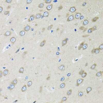 Immunohistochemistry-Paraffin: OGDH Antibody - BSA Free [NBP2-94086]