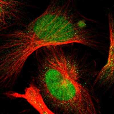 Immunocytochemistry/ Immunofluorescence: OGFOD1 Antibody [NBP1-83826]