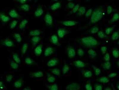 Immunocytochemistry/ Immunofluorescence: OGFOD1 Antibody (OTI1D9) - Azide and BSA Free [NBP2-73145]