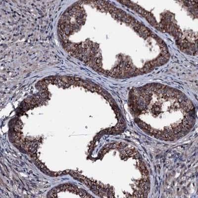 Immunohistochemistry-Paraffin: OGFOD2 Antibody [NBP1-82253]