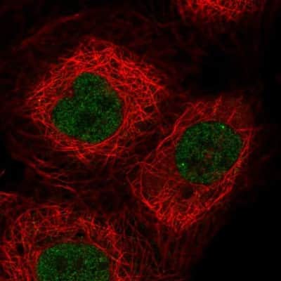Immunocytochemistry/ Immunofluorescence: OGFOD3 Antibody [NBP2-14387]