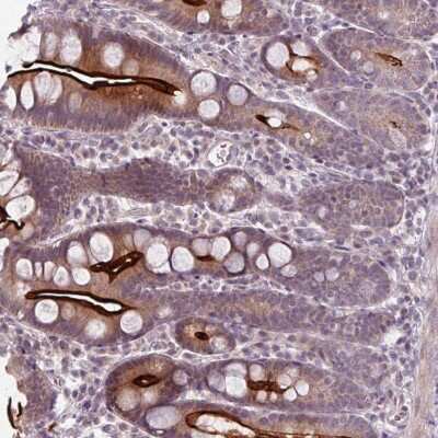 Immunohistochemistry-Paraffin: OGFOD3 Antibody [NBP2-14387]