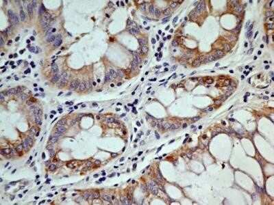 Immunohistochemistry: OGG1 Antibody (2B4) - Azide and BSA Free [NBP2-80891]