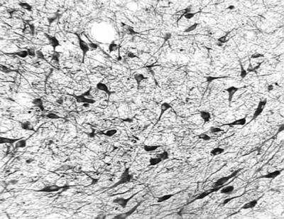 Immunohistochemistry-Frozen: OGG1 Antibody - BSA Free [NB100-106]