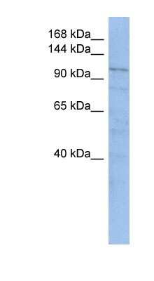 Western Blot: OIP106 Antibody [NBP1-56761]