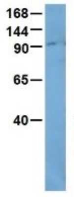 Western Blot: OIP106 Antibody [NBP1-56761]