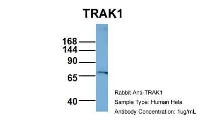 Western Blot: OIP106 Antibody [NBP1-56761]