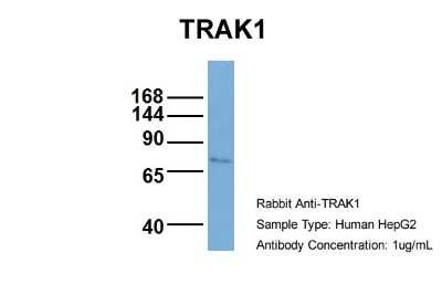 Western Blot: OIP106 Antibody [NBP1-56761]