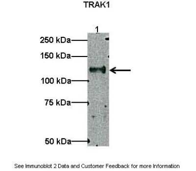 Western Blot: OIP106 Antibody [NBP1-56761]