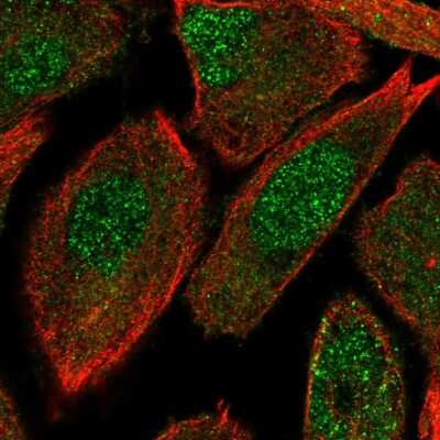 Immunocytochemistry/ Immunofluorescence: OIP5 Antibody [NBP2-13688]
