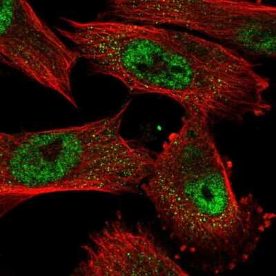 Immunocytochemistry/ Immunofluorescence: OIP5 Antibody [NBP2-56649]