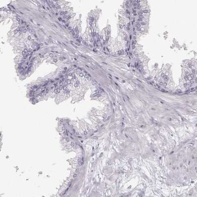 Immunohistochemistry-Paraffin: OIP5 Antibody [NBP2-56649]
