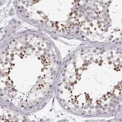 Immunohistochemistry-Paraffin: OIP5 Antibody [NBP2-56649]