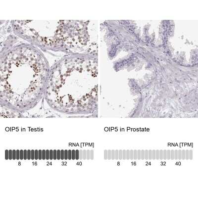 Immunohistochemistry-Paraffin: OIP5 Antibody [NBP2-56649]