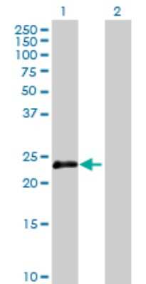 Western Blot: OIP5 Antibody [H00011339-B01P]
