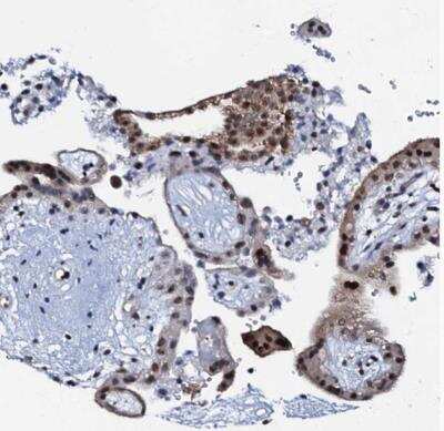 Immunohistochemistry-Paraffin: OLAH Antibody [NBP1-83779]