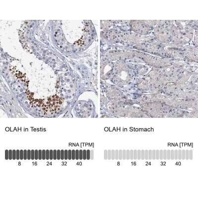 Immunohistochemistry-Paraffin: OLAH Antibody [NBP1-83780]