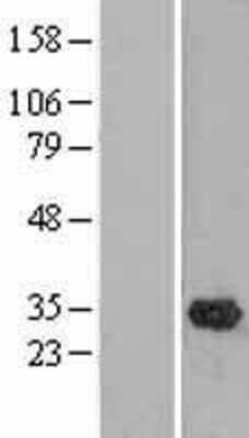 Western Blot: OLAH Overexpression Lysate [NBL1-13924]