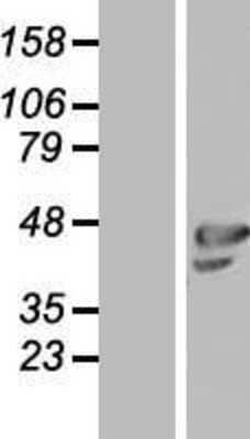 Western Blot: OLFML1 Overexpression Lysate [NBL1-13929]