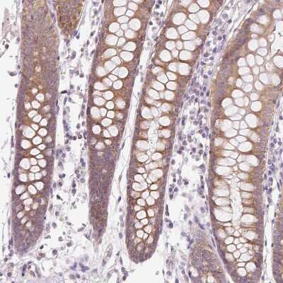 Immunohistochemistry-Paraffin: OMA1 Antibody [NBP2-30971]
