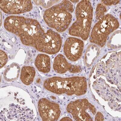 Immunohistochemistry-Paraffin: OMA1 Antibody [NBP2-30971]