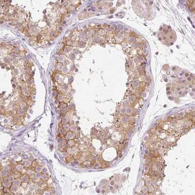 Immunohistochemistry-Paraffin: OMA1 Antibody [NBP2-30971]