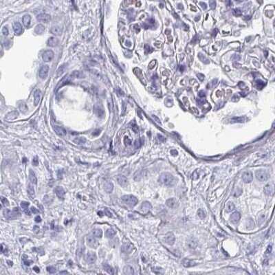 Immunohistochemistry-Paraffin: OMgp Antibody [NBP1-82483]