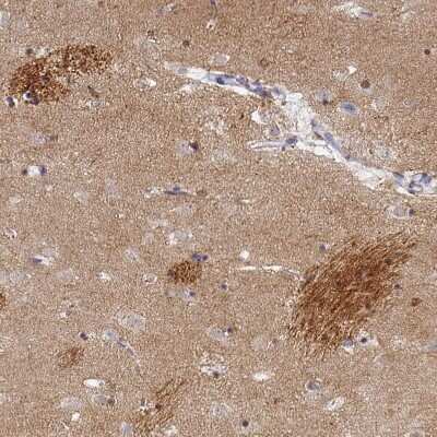 Immunohistochemistry-Paraffin: OMgp Antibody [NBP1-82483]