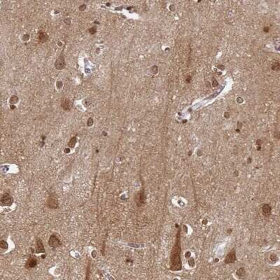 Immunohistochemistry-Paraffin: OMgp Antibody [NBP1-82483]