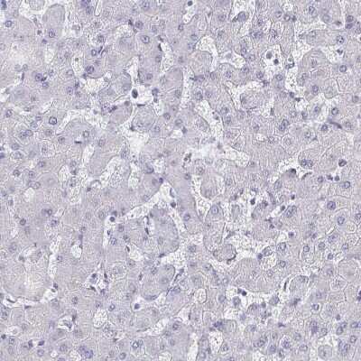 Immunohistochemistry-Paraffin: OMgp Antibody [NBP1-82483]