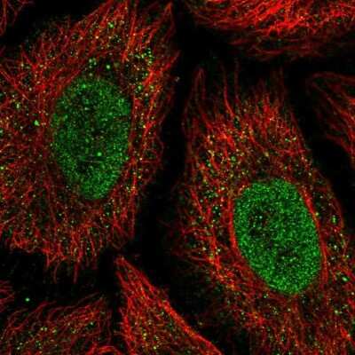 Immunocytochemistry/ Immunofluorescence: ONECUT2/OC-2 Antibody [NBP2-31658]