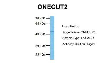Western Blot: ONECUT2/OC-2 Antibody [NBP2-87944]