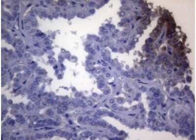 Immunohistochemistry: OPA3 Antibody (OTI3G4) - Azide and BSA Free [NBP2-73147]