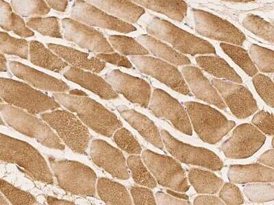 Immunohistochemistry-Paraffin: OPAL1 Antibody [NBP2-98185]